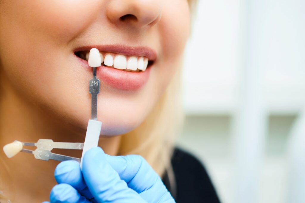 Dental Crowns in Irvine, CA